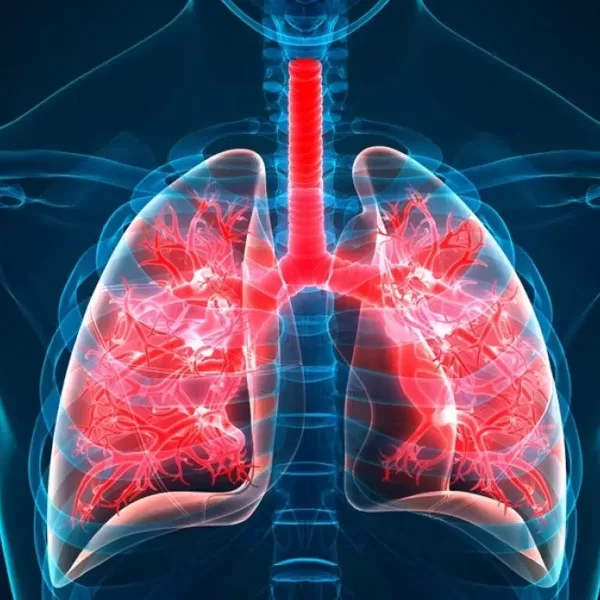 Cystic Fibrosis: New Advances and Symptom Management